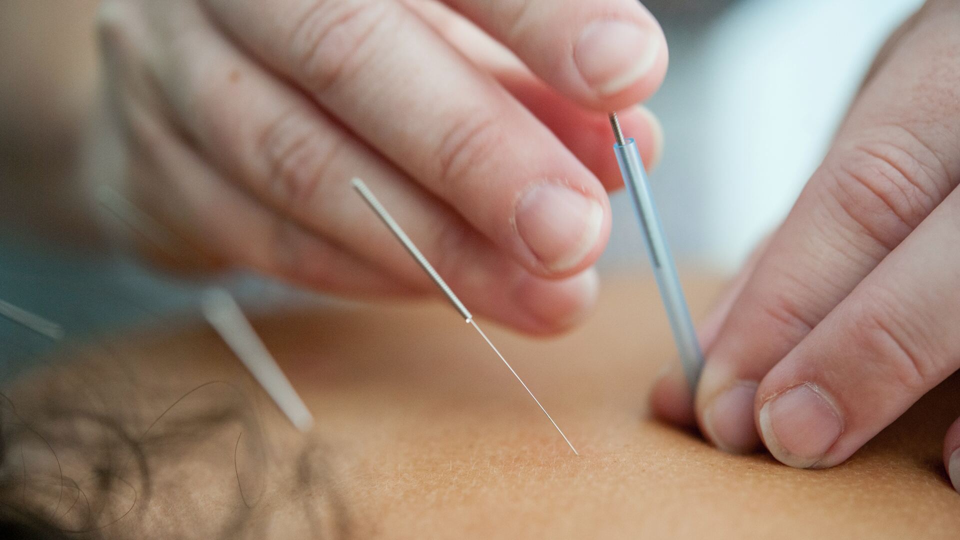 Acupuncture apps