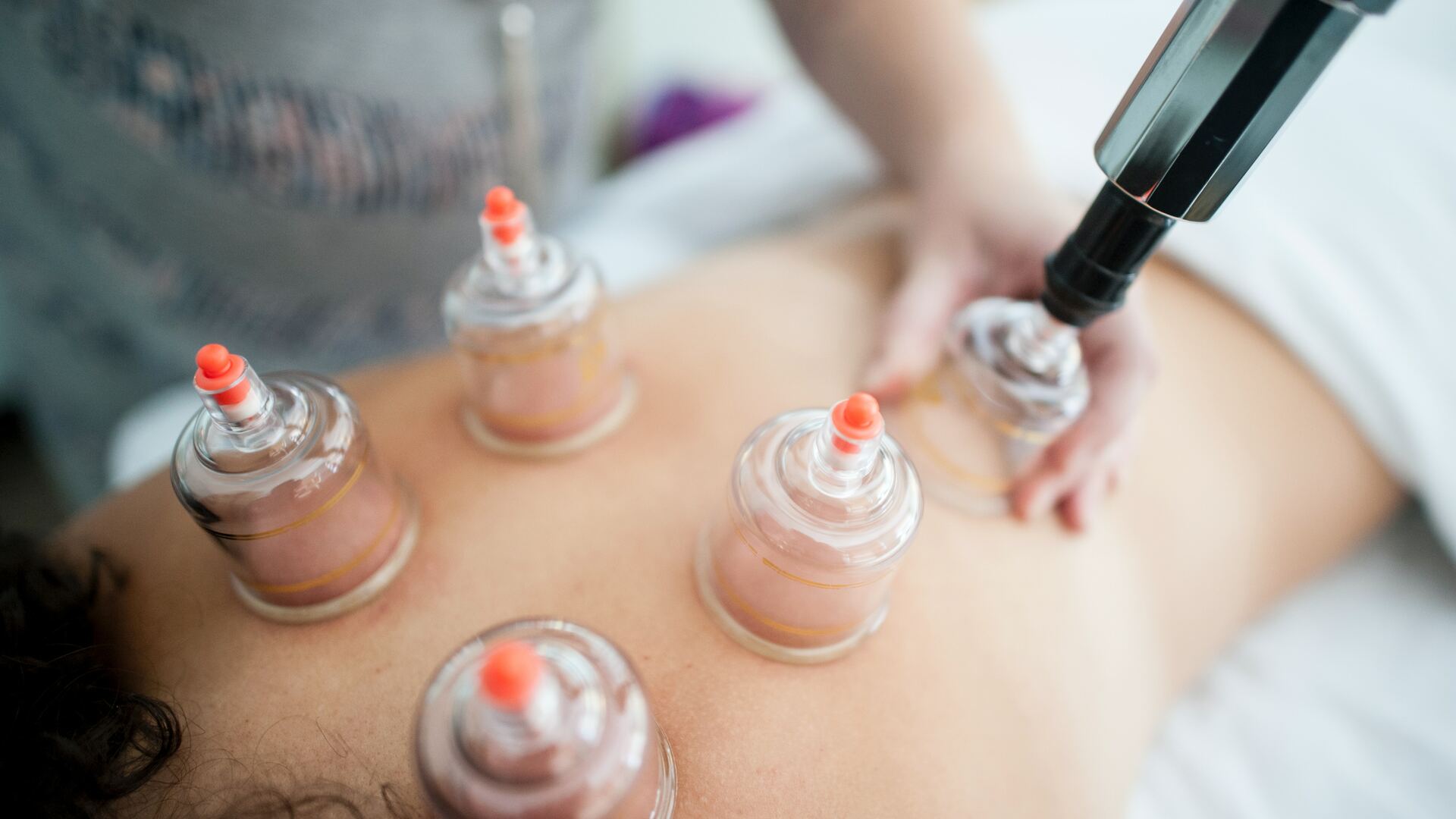 Cupping apps